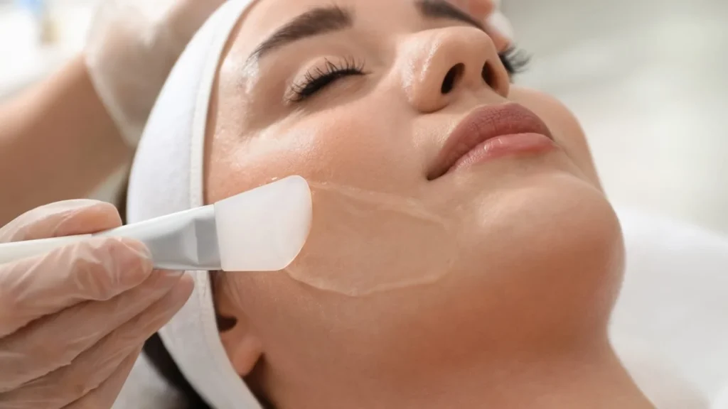 Chemical Peels